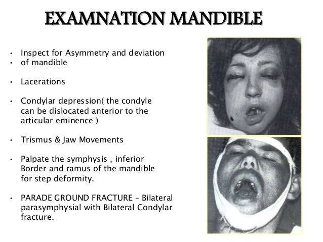 evaluate facial trauma Evaluate facial trauma